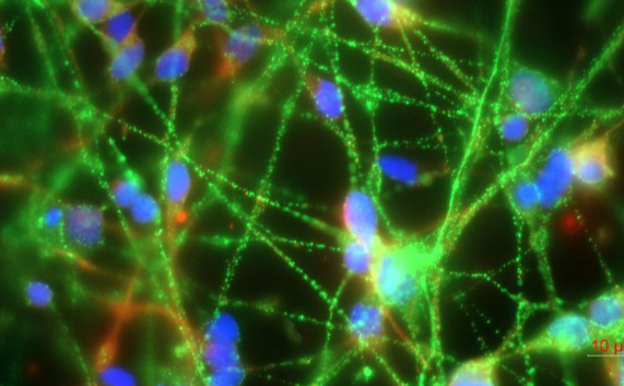 Human neurons grown in culture, labeled for proteins MAP2 and GAP43, showing neuroprotective effects of Ellorarxine in neurodegenerative disease models.